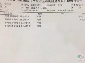 单纯疱疹病毒1型igg抗体阳性可以用nbb男士修护膏吗?