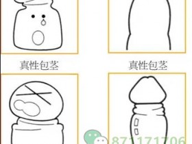 包皮过长和包茎准备要做手术的一定要看!